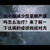 血小板减少性紫癜严重吗怎么治疗？来了解一下这病的症状和应对方法！